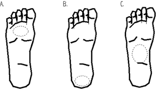 bal1