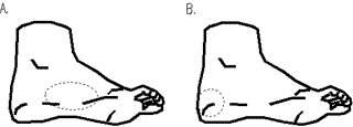 bal3